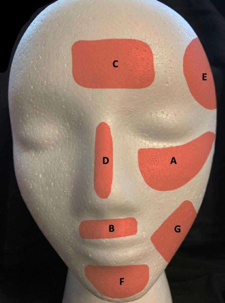 https://cdn.ncbi.nlm.nih.gov/pmc/blobs/d0a0/8110291/d9b39f1efcc6/cureus-0013-00000014398-i01.jpg