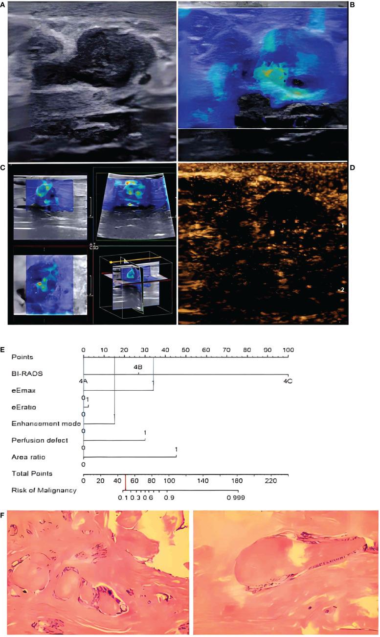 https://cdn.ncbi.nlm.nih.gov/pmc/blobs/d0a8/9730703/8e655f5b8d1a/fonc-12-1053280-g007.jpg
