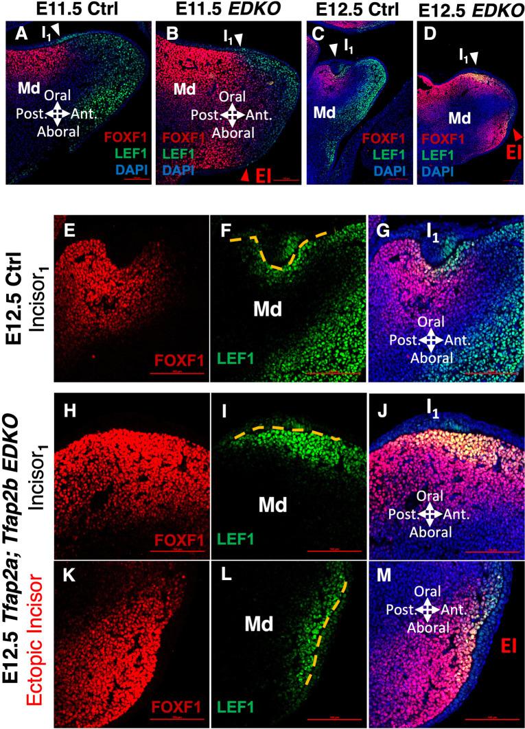 https://cdn.ncbi.nlm.nih.gov/pmc/blobs/d0b7/11302917/77a01b5b627e/pgen.1011364.g006.jpg