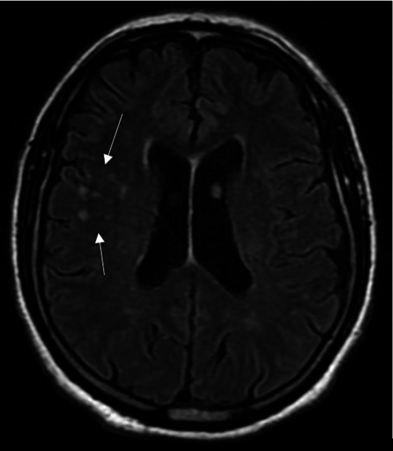 https://cdn.ncbi.nlm.nih.gov/pmc/blobs/d0b7/7805512/9ee4578105a7/cureus-0012-00000012094-i01.jpg