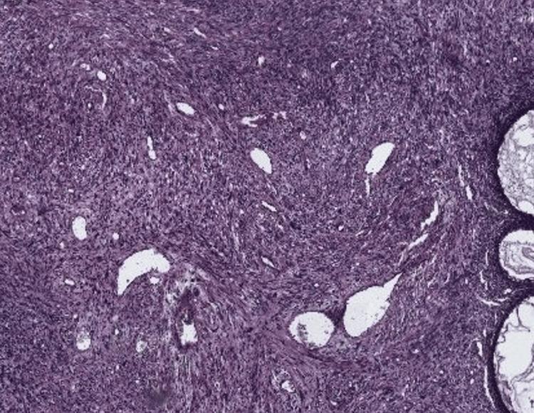 https://cdn.ncbi.nlm.nih.gov/pmc/blobs/d0b8/12393134/d6619a1dd5c7/cureus-0017-00000088983-i02.jpg
