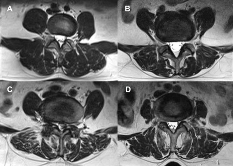 https://cdn.ncbi.nlm.nih.gov/pmc/blobs/d0c1/9664928/03fdddaa206d/JPR-15-3563-g0002.jpg