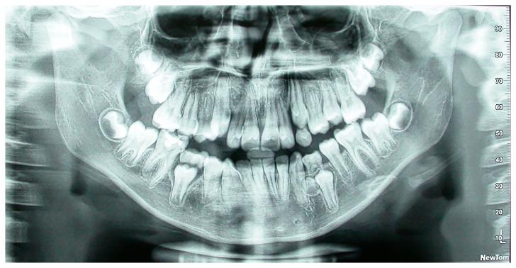 https://cdn.ncbi.nlm.nih.gov/pmc/blobs/d0c9/12293686/6e6f2d1a1430/dentistry-13-00317-g001.jpg