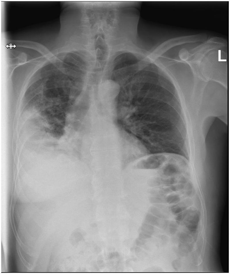 https://cdn.ncbi.nlm.nih.gov/pmc/blobs/d0ca/12392429/870bb680035d/ZECR_A_2546685_F0001_B.jpg