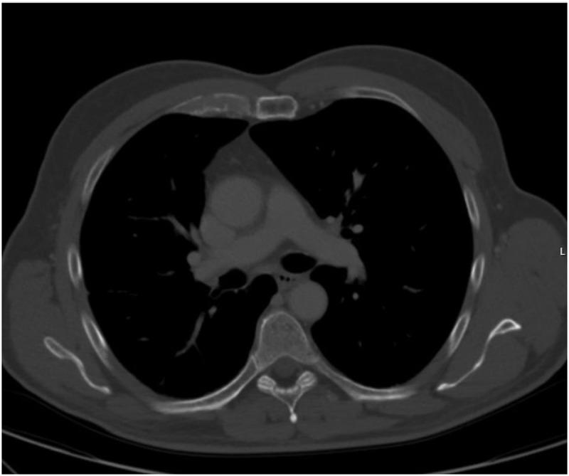 https://cdn.ncbi.nlm.nih.gov/pmc/blobs/d0ca/12392429/dd6ec47b40f1/ZECR_A_2546685_F0003_B.jpg
