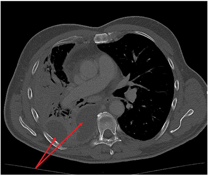 https://cdn.ncbi.nlm.nih.gov/pmc/blobs/d0ca/12392429/e5099ab28f43/ZECR_A_2546685_F0002_OC.jpg