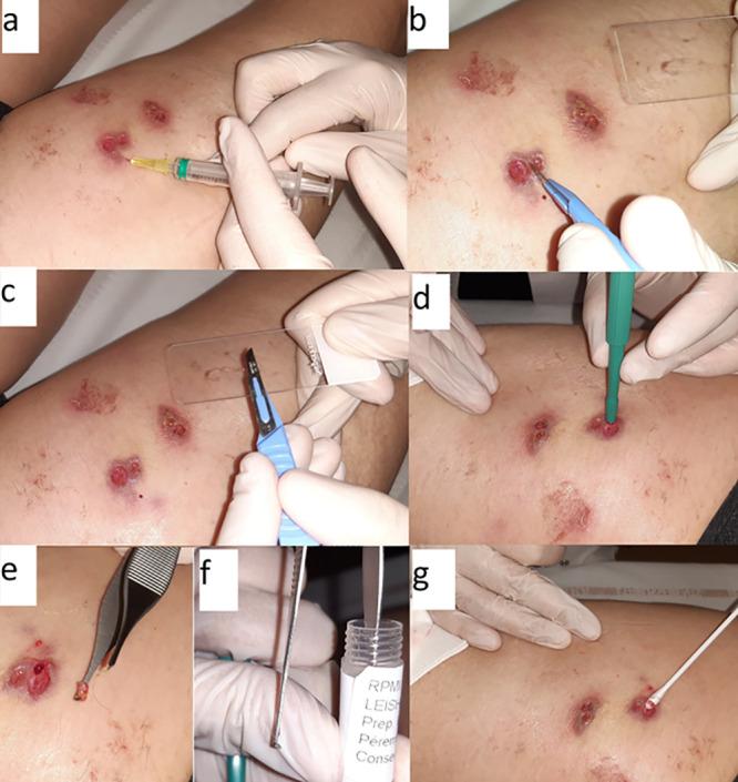 https://cdn.ncbi.nlm.nih.gov/pmc/blobs/d0cd/8111157/07ddffcf19e9/JCM.02218-20-f0002.jpg