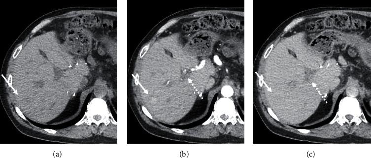 https://cdn.ncbi.nlm.nih.gov/pmc/blobs/d0d3/7556100/1ac8f4967606/CRIT2020-8824099.003.jpg