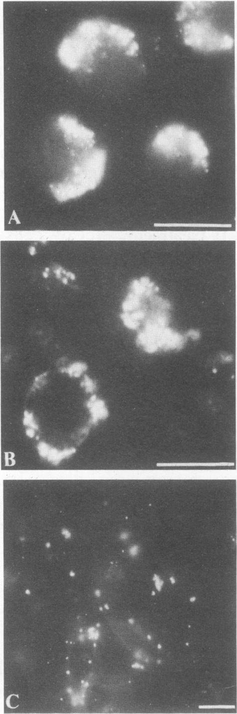https://cdn.ncbi.nlm.nih.gov/pmc/blobs/d0d5/259064/6225782059c9/iai00048-0188-a.jpg