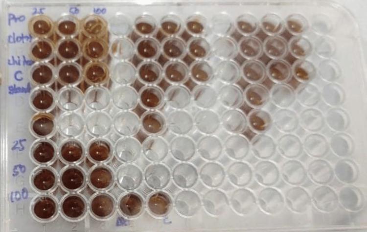 https://cdn.ncbi.nlm.nih.gov/pmc/blobs/d0d6/11501512/bb4eaf22380b/cureus-0016-00000070093-i08.jpg