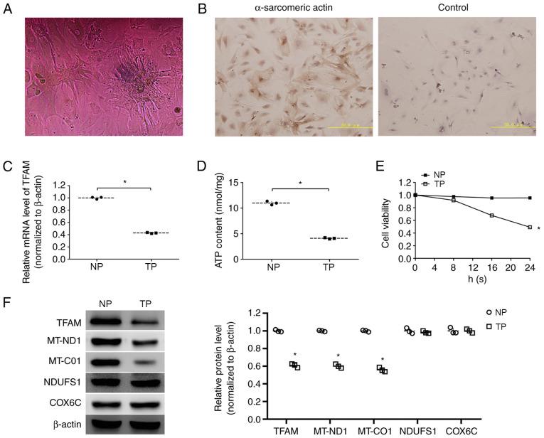 https://cdn.ncbi.nlm.nih.gov/pmc/blobs/d0d6/7646973/4fe17bd6e338/MMR-22-06-5105-g01.jpg