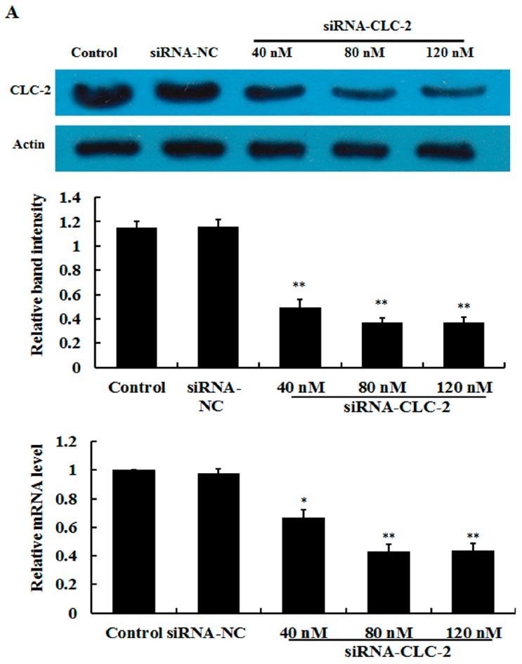https://cdn.ncbi.nlm.nih.gov/pmc/blobs/d0d9/4926444/45594c0fae09/ijms-17-00910-g001a.jpg