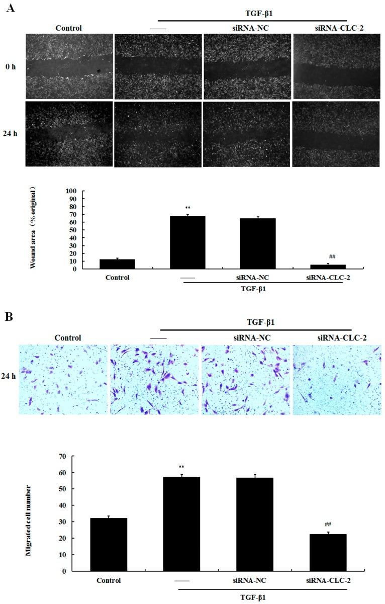 https://cdn.ncbi.nlm.nih.gov/pmc/blobs/d0d9/4926444/73bf8e9bee60/ijms-17-00910-g004.jpg