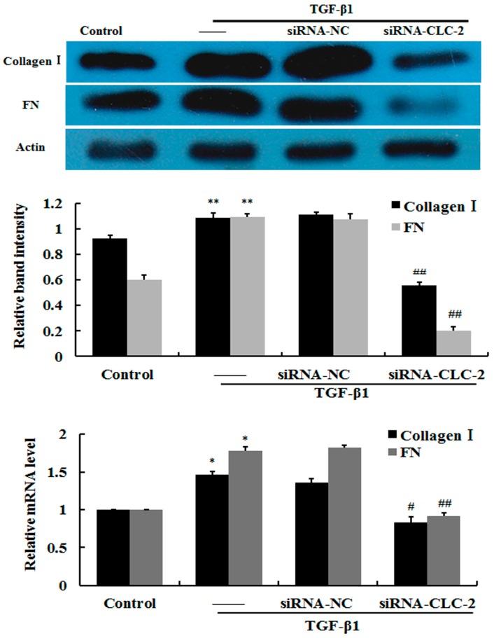 https://cdn.ncbi.nlm.nih.gov/pmc/blobs/d0d9/4926444/9ca1705cf4f0/ijms-17-00910-g003.jpg