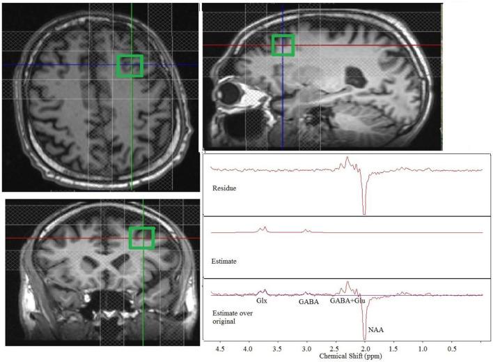 https://cdn.ncbi.nlm.nih.gov/pmc/blobs/d0d9/8677827/acfa3c02a6c7/fpsyt-12-665347-g0001.jpg