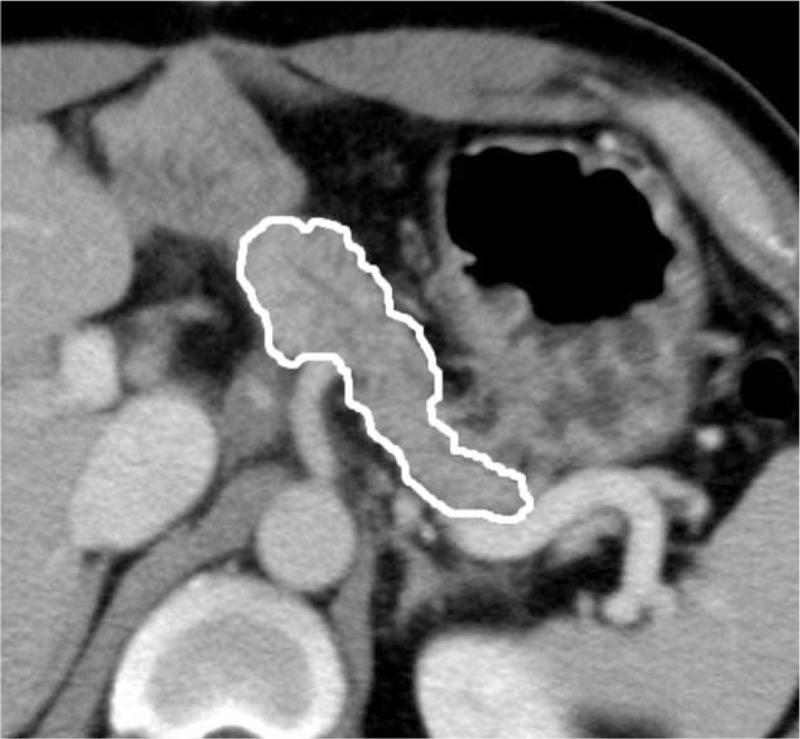 https://cdn.ncbi.nlm.nih.gov/pmc/blobs/d0df/4753867/d0b9bb9b9078/medi-95-e2535-g004.jpg