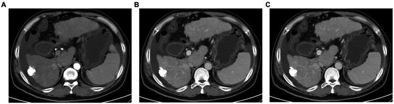 https://cdn.ncbi.nlm.nih.gov/pmc/blobs/d0e5/10461443/960d38ea3778/fmed-10-1231597-g002.jpg