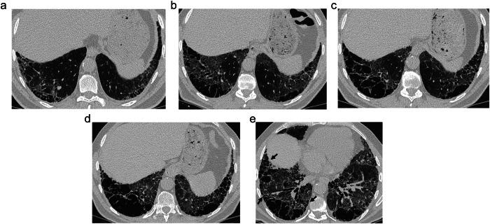 https://cdn.ncbi.nlm.nih.gov/pmc/blobs/d0e5/12443667/371694cd8a0f/13244_2025_2074_Fig5_HTML.jpg