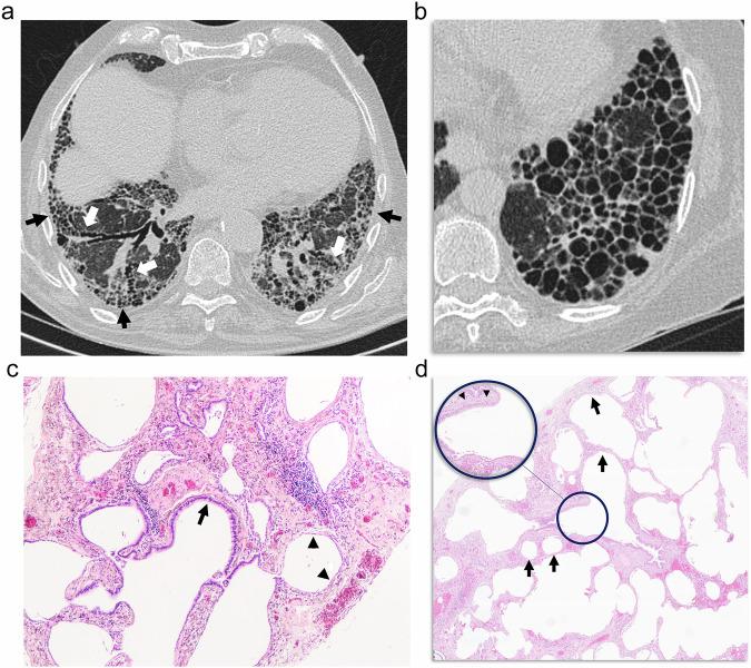 https://cdn.ncbi.nlm.nih.gov/pmc/blobs/d0e5/12443667/d93a8297b4c0/13244_2025_2074_Fig6_HTML.jpg