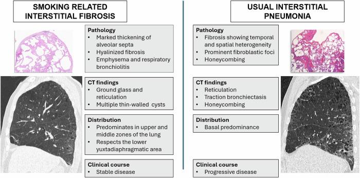 https://cdn.ncbi.nlm.nih.gov/pmc/blobs/d0e5/12443667/dbcea43e109d/13244_2025_2074_Fig12_HTML.jpg