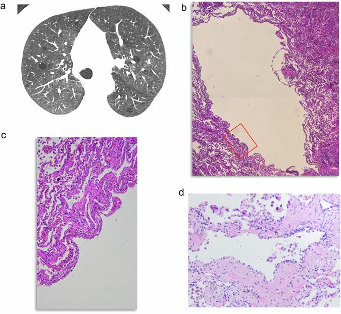 https://cdn.ncbi.nlm.nih.gov/pmc/blobs/d0e5/12443667/f9565ef4067b/13244_2025_2074_Fig7_HTML.jpg