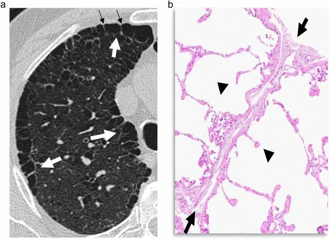 https://cdn.ncbi.nlm.nih.gov/pmc/blobs/d0e5/12443667/fcaa95cfef45/13244_2025_2074_Fig2_HTML.jpg