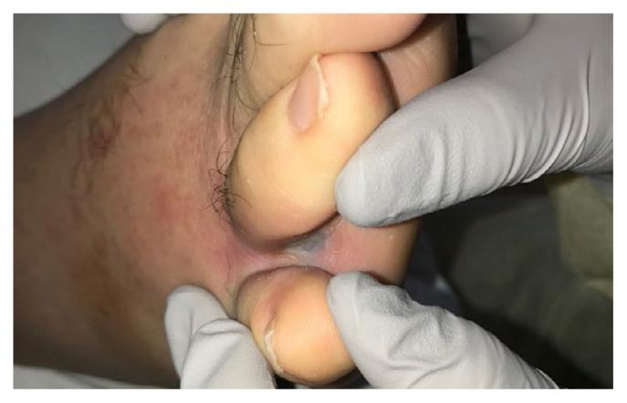 https://cdn.ncbi.nlm.nih.gov/pmc/blobs/d0e9/8942587/7e1e204735e8/15-67f1.jpg