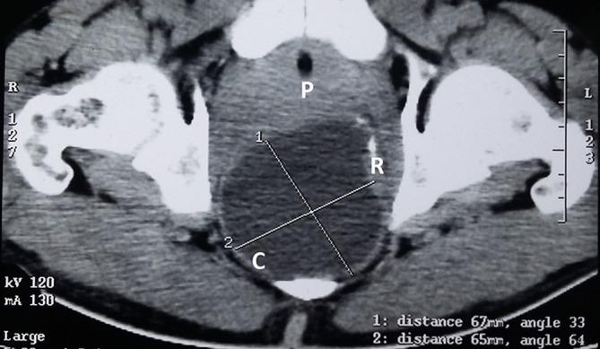 https://cdn.ncbi.nlm.nih.gov/pmc/blobs/d0ea/6159174/3a078d72fe29/bjrcr.20150422.g002.jpg