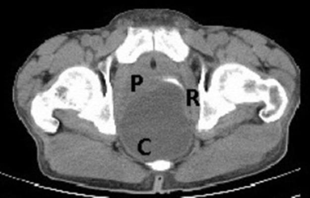 https://cdn.ncbi.nlm.nih.gov/pmc/blobs/d0ea/6159174/4adf9f0af934/bjrcr.20150422.g001.jpg