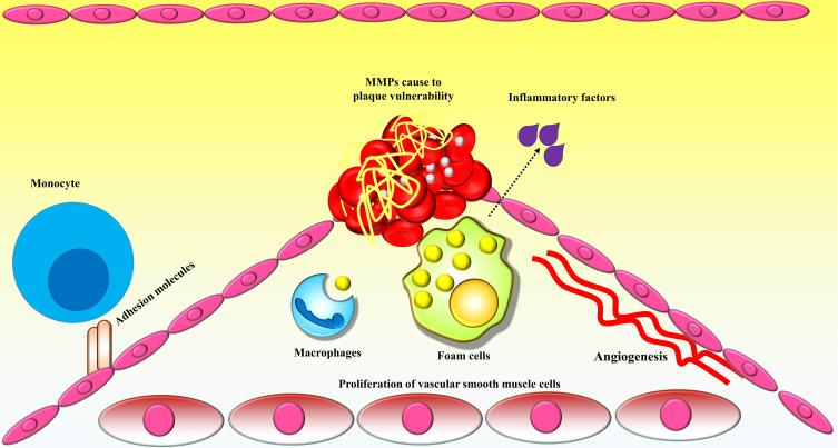https://cdn.ncbi.nlm.nih.gov/pmc/blobs/d106/7897977/3845db7d85cc/JIR-14-379-g0001.jpg