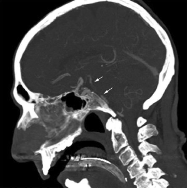 https://cdn.ncbi.nlm.nih.gov/pmc/blobs/d108/4896173/2416bc8cfcf4/gr3.jpg