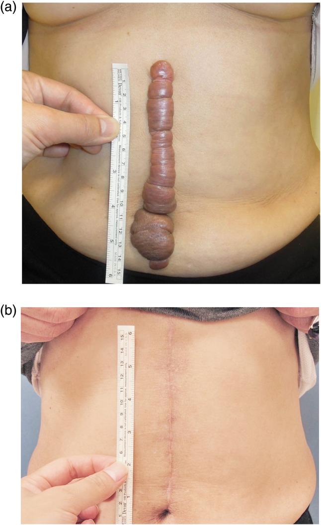 https://cdn.ncbi.nlm.nih.gov/pmc/blobs/d109/4202283/d0f1bf29d582/rru02504.jpg