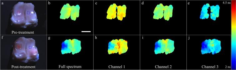 https://cdn.ncbi.nlm.nih.gov/pmc/blobs/d10c/7229199/e903c61fb575/41598_2020_65218_Fig2_HTML.jpg