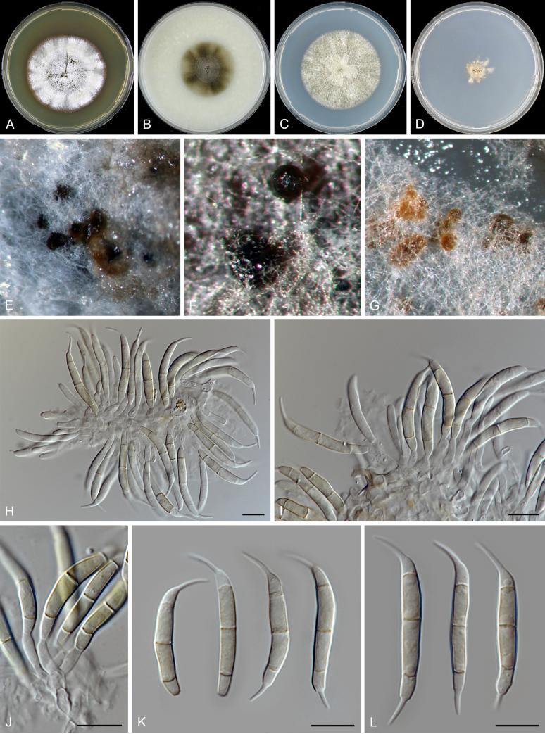 https://cdn.ncbi.nlm.nih.gov/pmc/blobs/d10e/6298422/6e887331fa5d/gr38.jpg