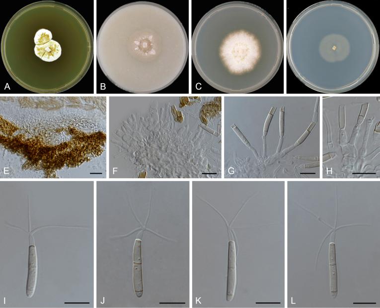 https://cdn.ncbi.nlm.nih.gov/pmc/blobs/d10e/6298422/7007250636d8/gr35.jpg
