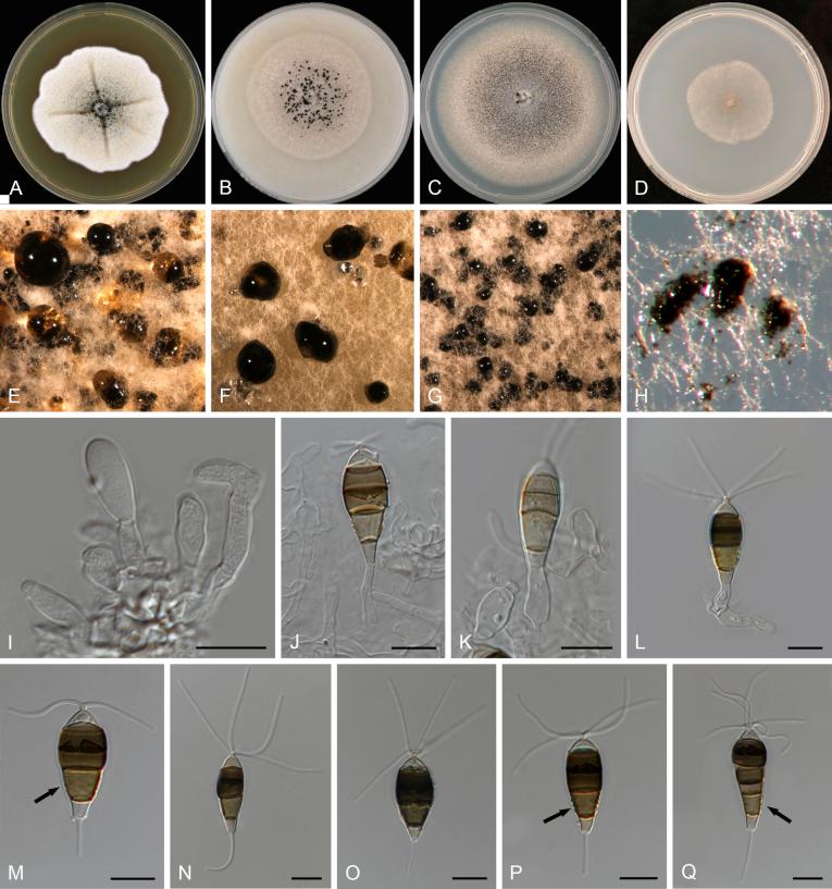 https://cdn.ncbi.nlm.nih.gov/pmc/blobs/d10e/6298422/b05fd16a22ec/gr18.jpg