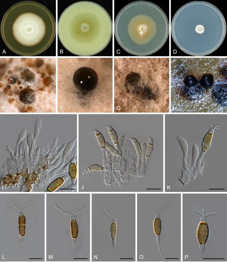 https://cdn.ncbi.nlm.nih.gov/pmc/blobs/d10e/6298422/b5494fc53d7b/gr20.jpg