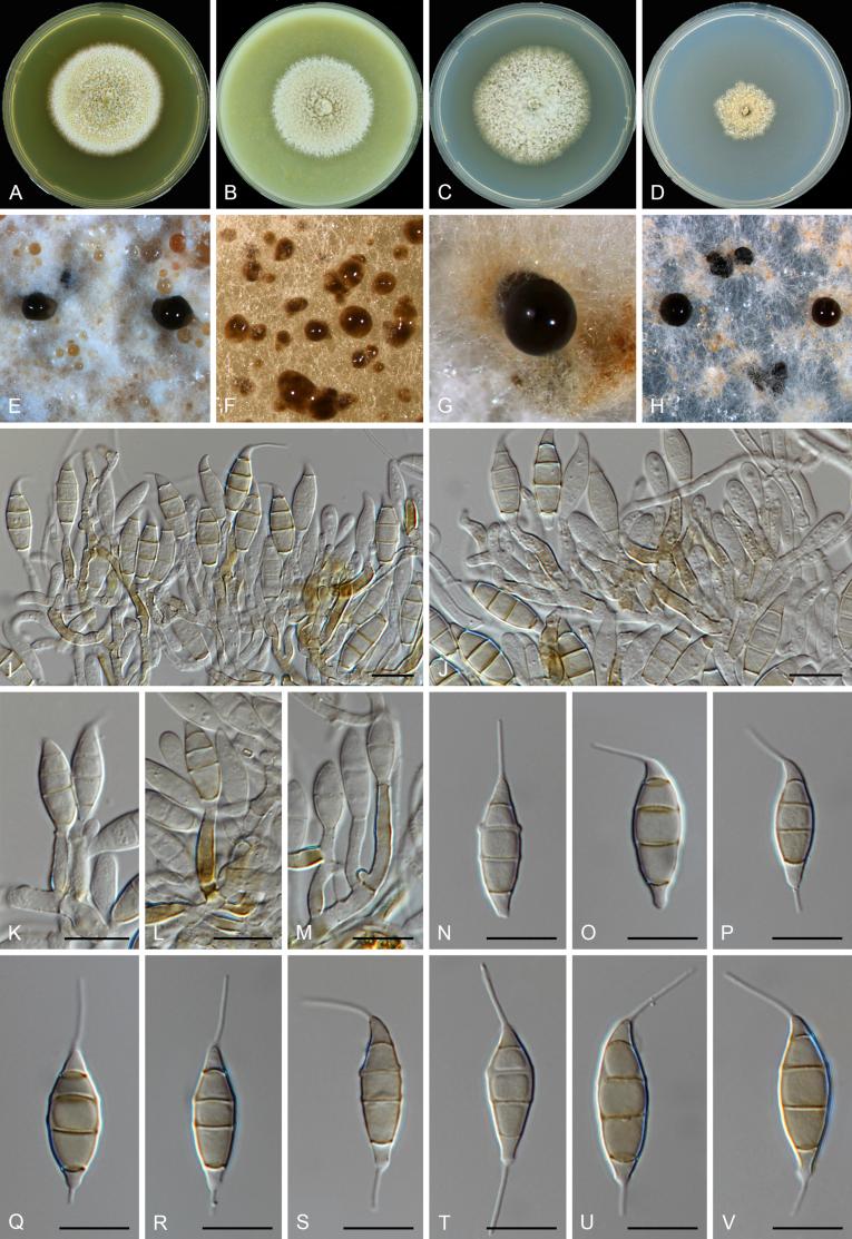 https://cdn.ncbi.nlm.nih.gov/pmc/blobs/d10e/6298422/ce35f850ec2f/gr39.jpg
