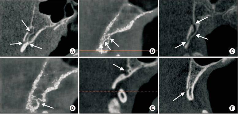https://cdn.ncbi.nlm.nih.gov/pmc/blobs/d112/9433859/963bd3e8e402/jkaoms-48-4-207-f2.jpg