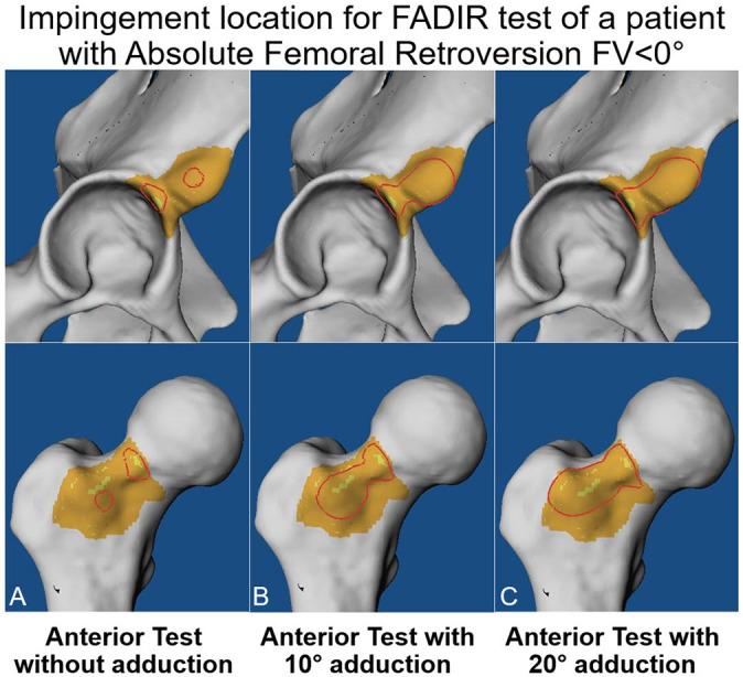 https://cdn.ncbi.nlm.nih.gov/pmc/blobs/d114/9950619/10c923c79d95/10.1177_23259671221148502-fig2.jpg