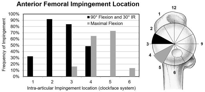 https://cdn.ncbi.nlm.nih.gov/pmc/blobs/d114/9950619/33d536409c40/10.1177_23259671221148502-fig4.jpg