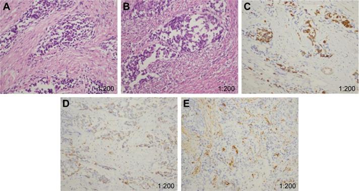 https://cdn.ncbi.nlm.nih.gov/pmc/blobs/d116/6302812/17db6a1959f6/ott-12-057Fig2.jpg