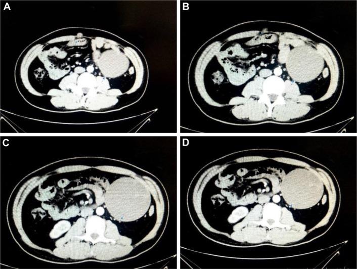 https://cdn.ncbi.nlm.nih.gov/pmc/blobs/d116/6302812/5cbaf7fe25f8/ott-12-057Fig1.jpg