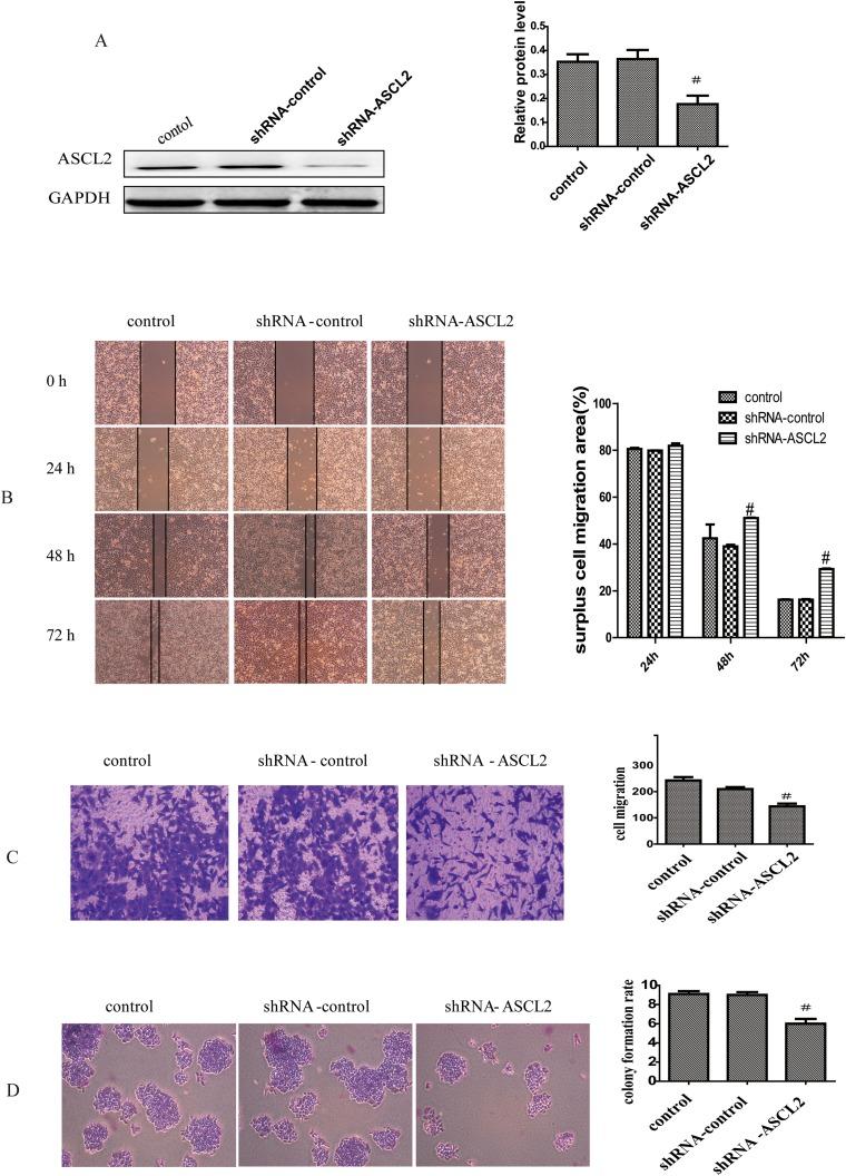 https://cdn.ncbi.nlm.nih.gov/pmc/blobs/d118/5955089/4b659cfb536d/oncotarget-09-23320-g002.jpg