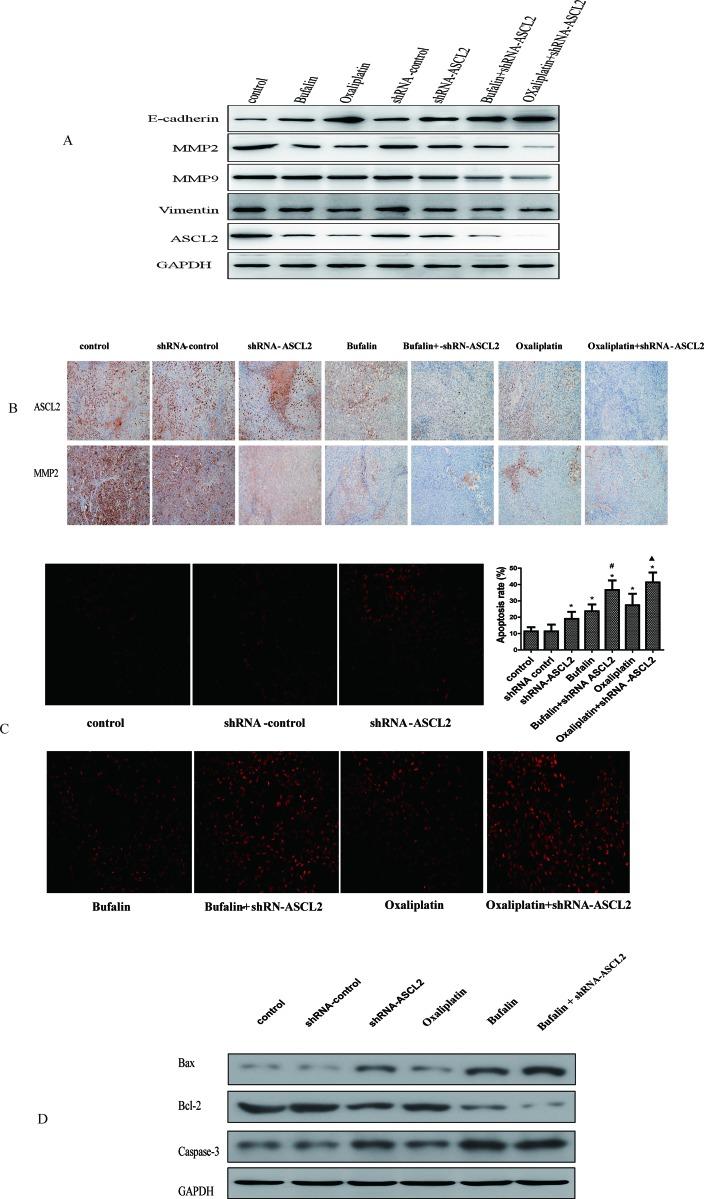 https://cdn.ncbi.nlm.nih.gov/pmc/blobs/d118/5955089/ddd3268f858f/oncotarget-09-23320-g006.jpg