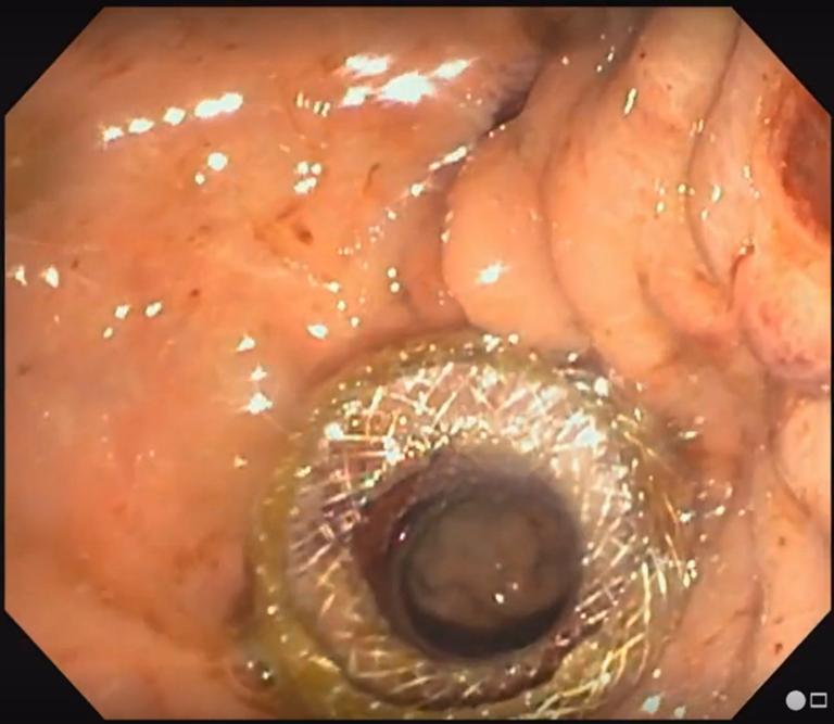 https://cdn.ncbi.nlm.nih.gov/pmc/blobs/d119/10256954/24e1462cac68/gr5.jpg
