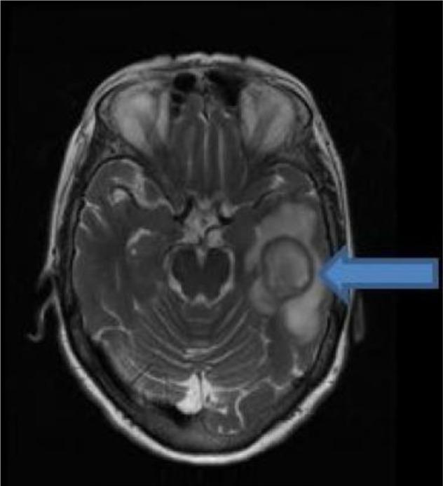 https://cdn.ncbi.nlm.nih.gov/pmc/blobs/d119/5271399/1da2a8314add/imcrj-10-025Fig2.jpg
