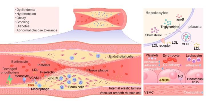 https://cdn.ncbi.nlm.nih.gov/pmc/blobs/d123/8947823/1722c8f04077/AD-13-2-491-g1.jpg