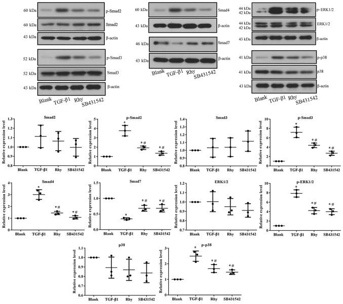 https://cdn.ncbi.nlm.nih.gov/pmc/blobs/d129/6307401/d8b7121e55ba/etm-17-01-0251-g06.jpg