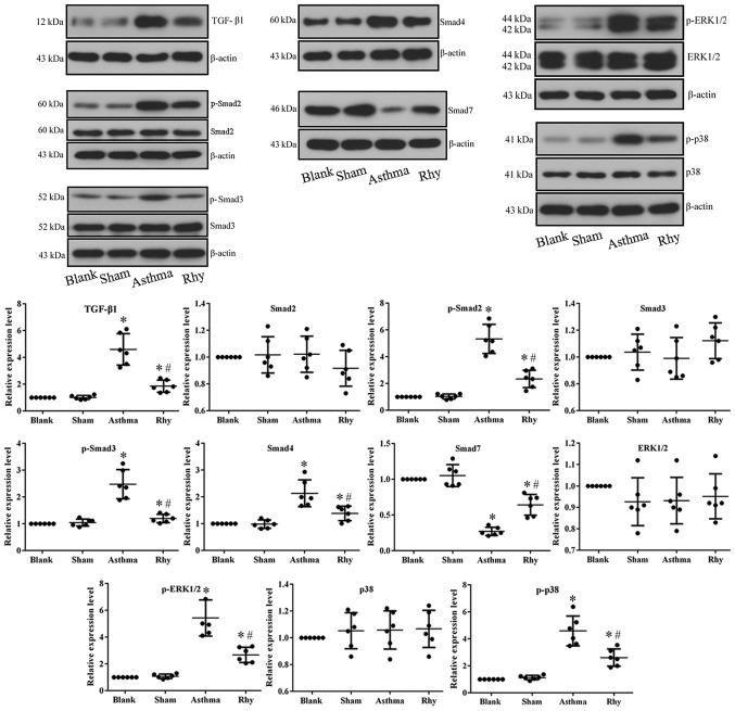 https://cdn.ncbi.nlm.nih.gov/pmc/blobs/d129/6307401/e2ac80e34f38/etm-17-01-0251-g04.jpg